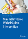 Minimalinvasive  Wirbelsäulenintervention